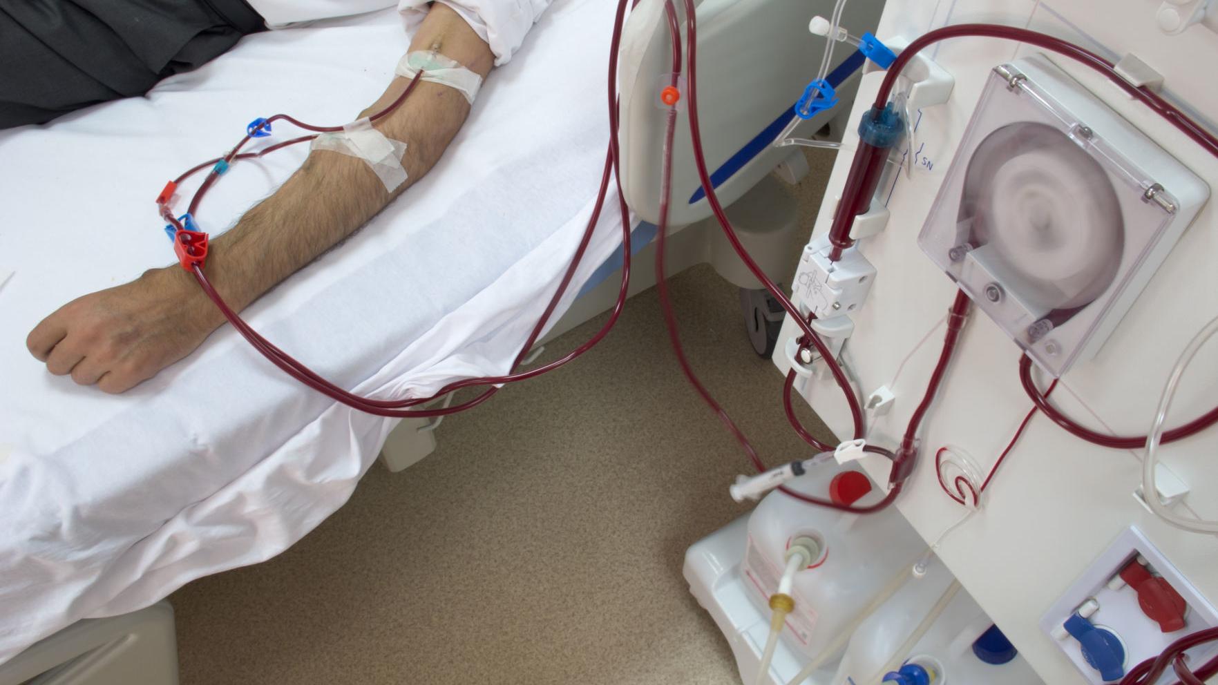 Proposal to cap dialysis costs won't be on Arizona ballot, but plenty of other measures will